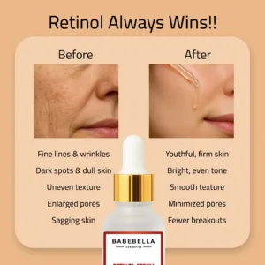 Babebella Retinol Serum – Before and After Fine Lines & Wrinkles
