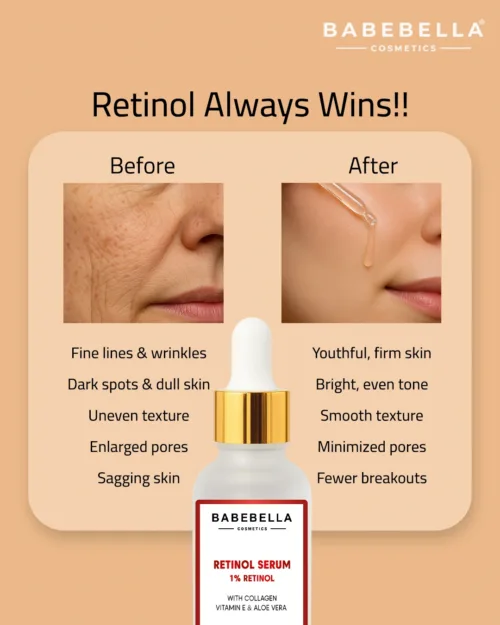 Babebella Retinol Serum – Before and After Fine Lines & Wrinkles