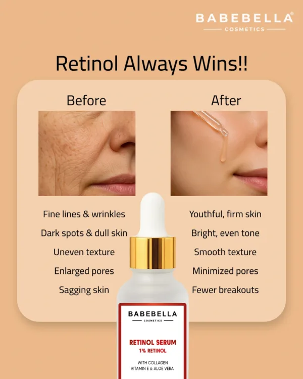 Babebella Retinol Serum – Before and After Fine Lines & Wrinkles