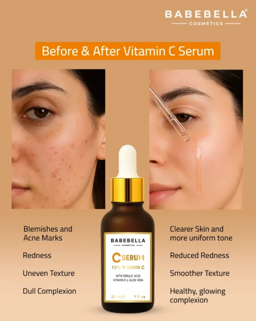 Babebella Vitamin C Serum – Before and After Dark Spots & Dull Skin