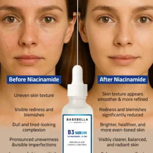 Babebella Niacinamide Serum – Before and After Dark Spots & Redness