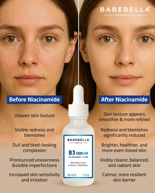 Babebella Niacinamide Serum – Before and After Dark Spots & Redness