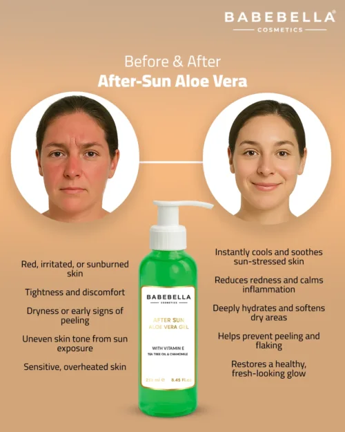 Babebella Aloe Vera Gel – Before and After Sunburn Relief Results