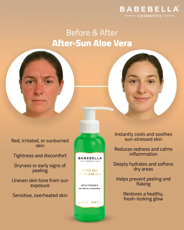 Babebella Aloe Vera Gel – Before and After Sunburn Relief Results