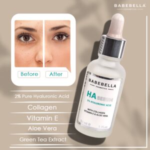 hyaluronic acid