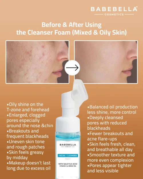 Babebella Facial Foam Cleanser – Before and After Results for Oily Skin