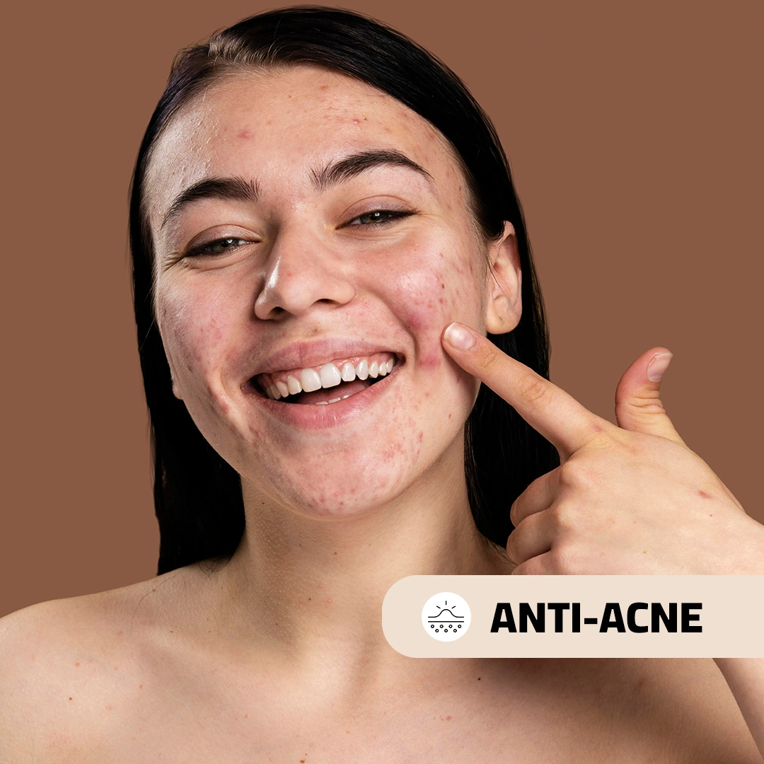 Anti Acne